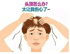 西寧治療脫發多少錢